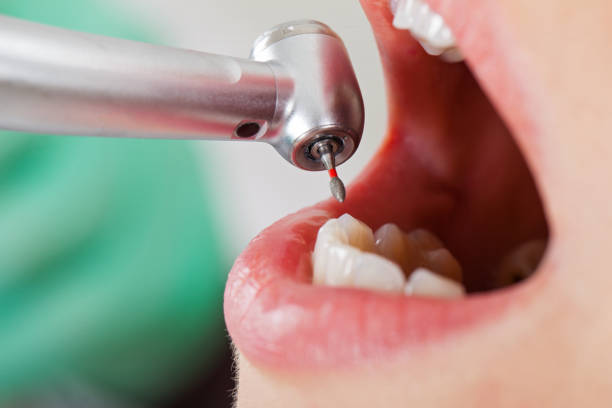 Best Emergency Denture Repair in Lamar, TX